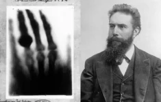 První rentgenový snímek vynálezcovu ženu spíše vyděsil. 