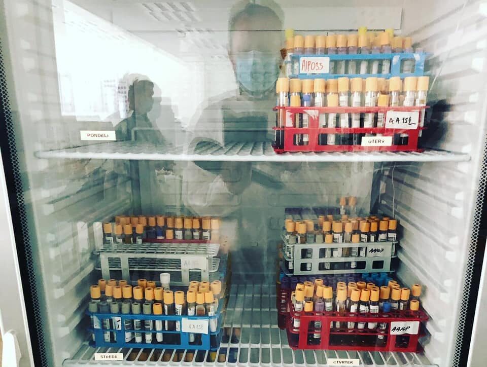 Reportér Jan Tuna hledí na vzorky krevního séra,  z nichž laboratoř zjišťovala přítomnost protilátek na koronavirus