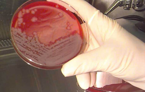 Mikrobiální kultivace bakterií sněti slezinné.
